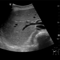Ultraschall des Bauchraums